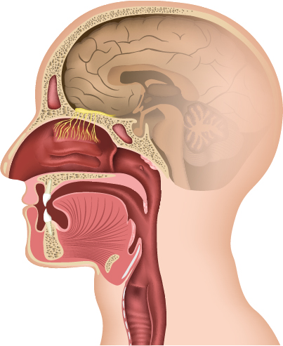 olfactory neuroblastoma